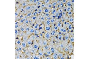 Immunohistochemistry of paraffin-embedded rat liver using RAF1 antibody (ABIN5970053) at dilution of 1/100 (40x lens). (RAF1 Antikörper  (C-Term))