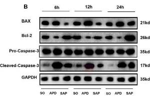 Western Blotting (WB) image for anti-B-Cell CLL/lymphoma 2 (BCL2) (N-Term) antibody (ABIN2857047)