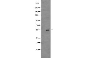 Western blot analysis of OR52Z1P expression in K562 cell line lysates ;,The lane on the left is treated with the antigen-specific peptide. (OR52Z1 Antikörper)