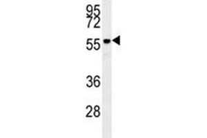 Anti-AKT2 antibody western blot analysis in mouse brain tissue lysate (AKT2 Antikörper)