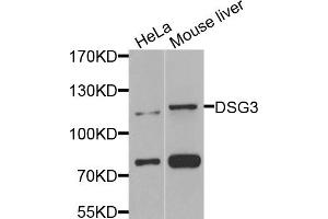 Western blot analysis of extracts of various cell lines, using DSG3 antibody (ABIN5974847) at 1/1000 dilution. (Desmoglein 3 Antikörper)