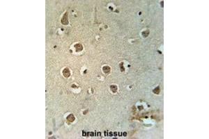 Immunohistochemistry (IHC) image for anti-Mitochondrial Carrier 2 (MTCH2) antibody (ABIN3002367) (MTCH2 Antikörper)