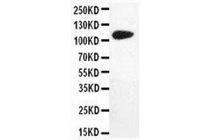 Anti-DPYD antibody, Western blotting WB: MM231 Cell Lysate (DPYD Antikörper  (N-Term))