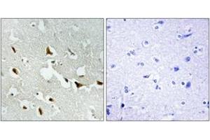 Immunohistochemistry analysis of paraffin-embedded human brain tissue, using IRS-1 (Ab-636) Antibody. (IRS1 Antikörper  (AA 603-652))