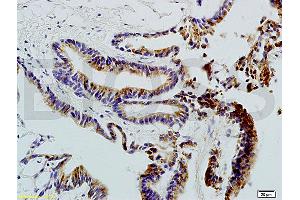 Formalin-fixed and paraffin embedded rat colon carcinoma labeled with Anti-CD20 Polyclonal Antibody , Unconjugated 1:200 followed by conjugation to the secondary antibody and DAB staining (CD20 Antikörper  (AA 133-182))