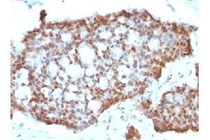 Immunohistochemistry (IHC) image for anti-Estrogen Receptor 2 (ESR2) (C-Term) antibody (ABIN3024797)