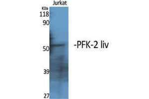 Western Blot (WB) analysis of specific cells using PFK-2 liv Polyclonal Antibody. (PFK-2 LIV (C-Term) Antikörper)