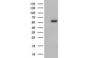 HEK293T cells were transfected with the pCMV6-ENTRY control (Left lane) or pCMV6-ENTRY KLHL2 (Right lane) cDNA for 48 hrs and lysed. (KLHL2 Antikörper  (AA 1-100, AA 494-593))