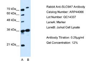 WB Suggested Anti-SLC9A7  Antibody Titration: 0. (NHE7 Antikörper  (N-Term))