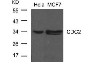 Image no. 2 for anti-Cyclin-Dependent Kinase 1 (CDK1) (Tyr15) antibody (ABIN197483) (CDK1 Antikörper  (Tyr15))