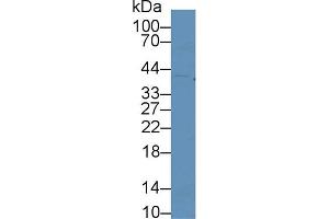 Western blot analysis of Human K562 cell lysate, using Mouse CDK2 Antibody (2 µg/ml) and HRP-conjugated Goat Anti-Rabbit antibody ( (CDK2 Antikörper  (AA 93-211))