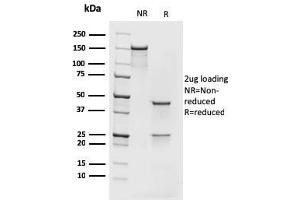 SDS-PAGE (SDS) image for anti-Minichromosome Maintenance Complex Component 7 (MCM7) (AA 195-319) antibody (ABIN6940023)