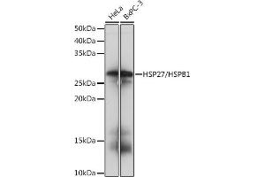 Western blot analysis of extracts of various cell lines, using HSP27/HSPB1Rabbit mAb (ABIN7267569) at 1:1000 dilution. (HSP27 Antikörper)