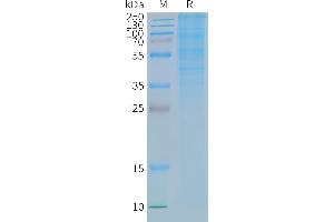 GLP1R Protein