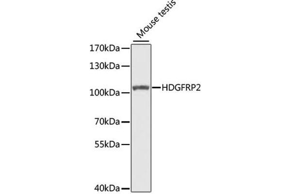 HDGFRP2 Antikörper  (AA 501-670)