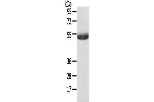 Western Blotting (WB) image for anti-1-Acylglycerol-3-Phosphate O-Acyltransferase 6 (Lysophosphatidic Acid Acyltransferase, Zeta) (AGPAT6) antibody (ABIN2427468) (AGPAT6 Antikörper)