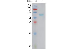 Human Protein, hFc Tag on SDS-PAGE under reducing condition. (CCL5 Protein (AA 24-91) (Fc Tag))