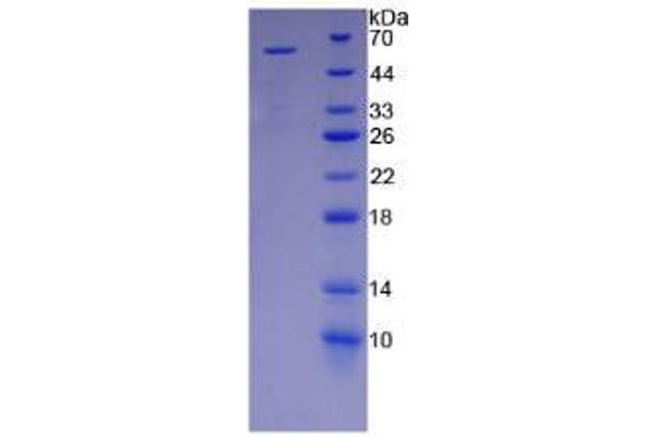 KIR2DS2 Protein