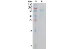 Cynomolgus T Protein, hFc Tag on SDS-PAGE under reducing condition. (TREM2 Protein (AA 19-174) (Fc Tag))