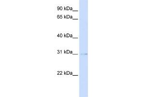 WB Suggested Anti-PVRIG Antibody Titration:  0. (PVRIG Antikörper  (Middle Region))