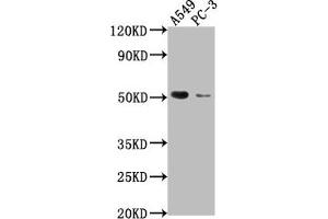 Western Blot Positive WB detected in: A549 whole cell lysate, PC-3 whole cell lysate All lanes: TNFRSF1A antibody at 1:2000 Secondary Goat polyclonal to rabbit IgG at 1/50000 dilution Predicted band size: 51, 39, 26, 25 kDa Observed band size: 51 kDa (TNFRSF1A Antikörper  (AA 249-455))