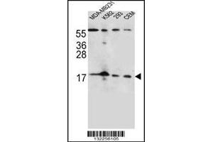 Western blot analysis in MDA-MB231,K562,293,CEM cell line lysates (35ug/lane). (FGF22 Antikörper  (N-Term))