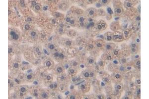 DAB staining on IHC-P; Samples: Mouse Liver Tissue (CCL4 Antikörper  (AA 24-92))