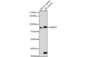 Western blot analysis of extracts of various cell lines, using MMP9 antibody (ABIN6134758, ABIN6143921, ABIN6143924 and ABIN6215080) at 1:1000 dilution. (MMP 9 Antikörper  (AA 400-500))