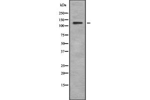 Western blot analysis USP36 using HuvEc whole cell lysates (USP36 Antikörper)