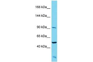 Host: Rabbit Target Name: PALD1 Sample Type: HepG2 Whole Cell lysates Antibody Dilution: 1. (KIAA1274 Antikörper  (N-Term))
