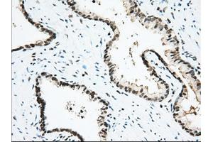 Immunohistochemical staining of paraffin-embedded Human Kidney tissue using anti-USP5 mouse monoclonal antibody. (USP5 Antikörper)