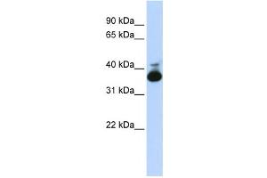 Western Blotting (WB) image for anti-Aldolase B, Fructose-Bisphosphate (ALDOB) antibody (ABIN2458580) (ALDOB Antikörper)