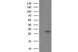 Western Blotting (WB) image for anti-Bridging Integrator 3 (BIN3) antibody (ABIN1496924) (BIN3 Antikörper)