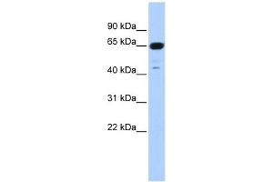 TRIM72 antibody used at 1 ug/ml to detect target protein. (TRIM72 Antikörper  (N-Term))