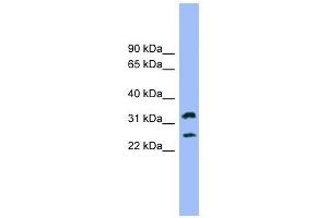 FCER1A antibody used at 1 ug/ml to detect target protein. (Fc epsilon RI/FCER1A Antikörper  (N-Term))