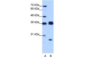 WB Suggested Anti-HNRPH3 Antibody Titration:  1. (HNRNPH3 Antikörper  (N-Term))