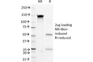 SDS-PAGE Analysis Purified CD36 Mouse Monoclonal Antibody (1E8). (CD36 Antikörper)