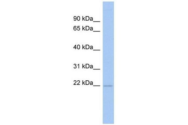 RWDD4A Antikörper  (N-Term)