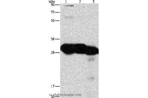 Western blot analysis of Mouse liver and kidney tissue, human fetal liver tissue, using KHK Polyclonal Antibody at dilution of 1:1350 (Ketohexokinase Antikörper)