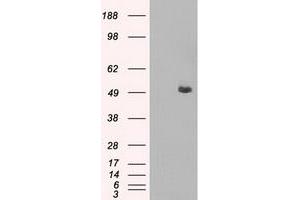 Western Blotting (WB) image for anti-CD4 (CD4) antibody (ABIN1497295) (CD4 Antikörper)