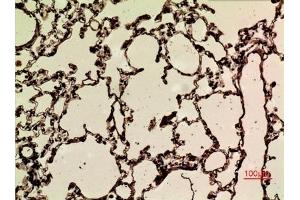 Immunohistochemical analysis of paraffin-embedded rat-lung, antibody was diluted at 1:100. (NRF2 Antikörper  (acLys599))