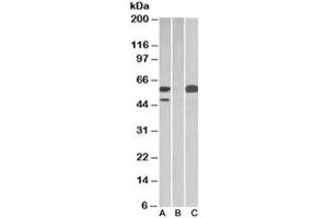 Western blot testing of HEK293 lysate overexpressing human TRIM21 with MYC tag with TRIM21 antibody [1ug/ml] in Lane A and probed with anti-MYC tag [1/1000] in lane C. (TRIM21 Antikörper)
