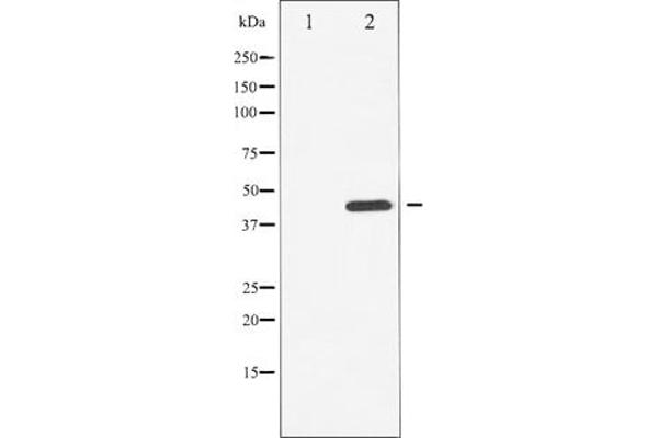 CHEK1 Antikörper  (pSer296)