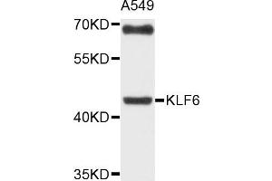 Western blot analysis of extracts of A549 cells, using KLF6 antibody. (KLF6 Antikörper)