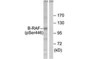 Western blot analysis of extracts from 293 cells treated with EGF 200ng/ml 30', using B-RAF (Phospho-Ser446) Antibody. (SNRPE Antikörper  (pSer446))