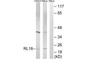 Western Blotting (WB) image for anti-Ribosomal Protein L18 (RPL18) (Internal Region) antibody (ABIN1850617) (RPL18 Antikörper  (Internal Region))