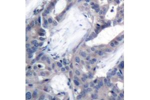 Immunohistochemistry (IHC) image for anti-Mitogen-Activated Protein Kinase Kinase 2 (MAP2K2) (pThr394) antibody (ABIN1870344) (MEK2 Antikörper  (pThr394))