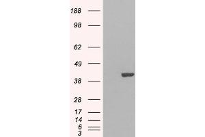 Western Blotting (WB) image for anti-GRB2-Related Adaptor Protein 2 (GRAP2) antibody (ABIN5901198) (GRAP2 Antikörper)