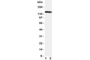 Western blot testing of COL2A1 antibody and Lane 1:  rat heart (COL2A1 Antikörper  (C-Term))