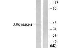 Western blot analysis of extracts from NIH-3T3 cells, using SEK1/MKK4 (Ab-80) Antibody. (MAP2K4 Antikörper  (AA 46-95))